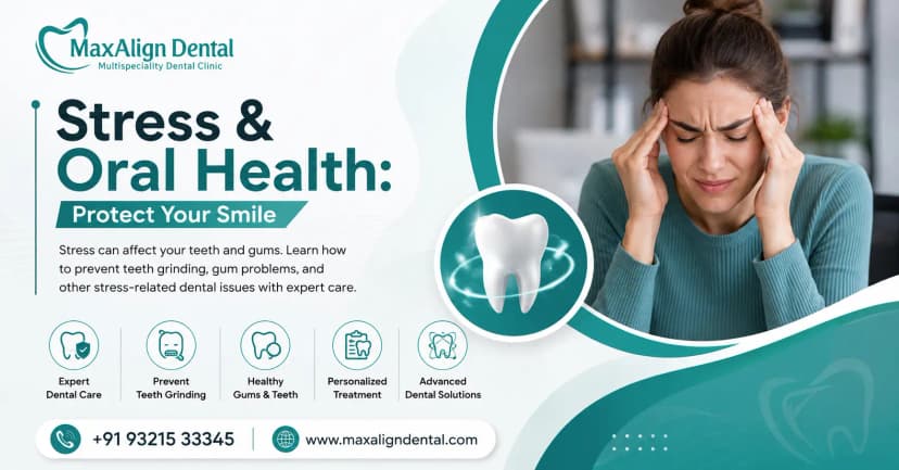 How Stress is Affecting Your Oral Health: A Growing Concern in Bangalore
